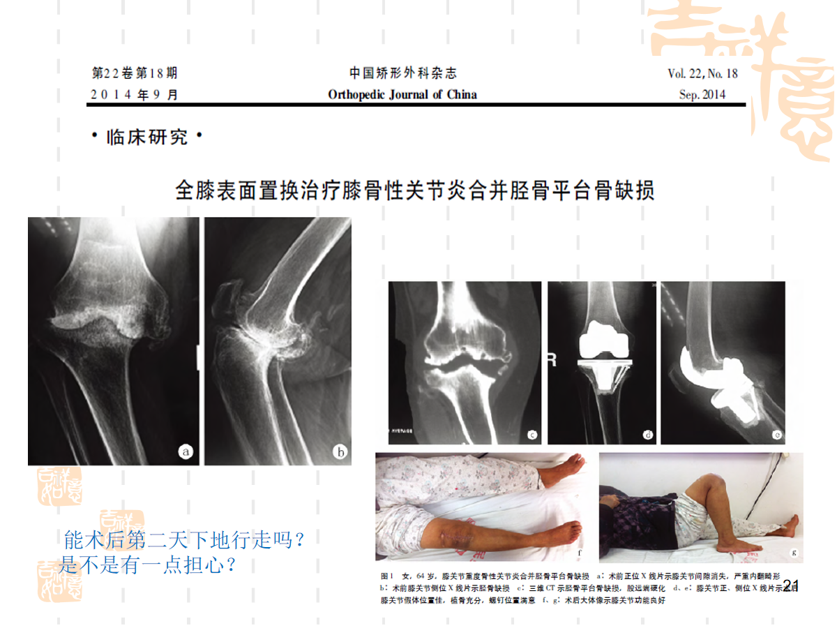 复杂初次全膝关节置换，遇到了该怎么办？