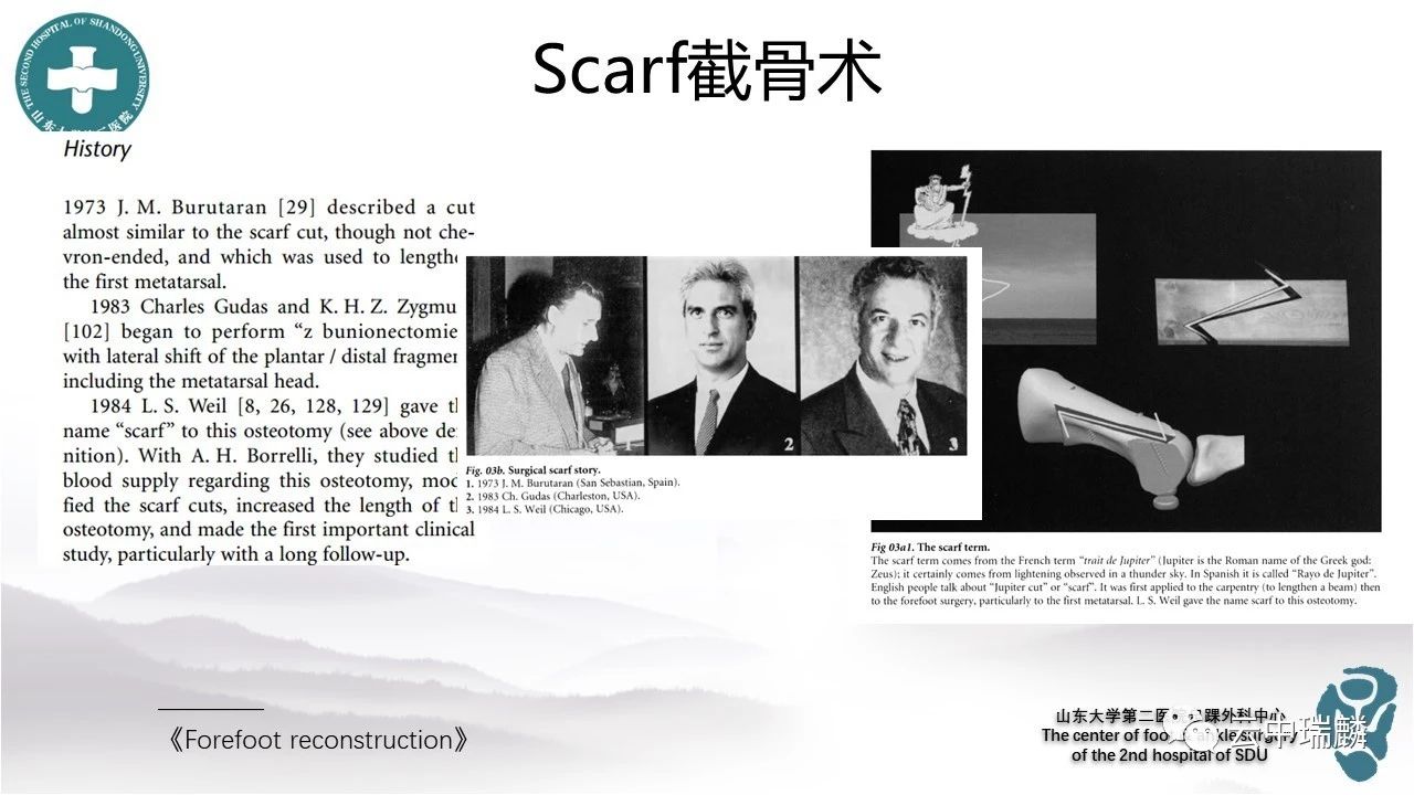 Scarf截骨术治疗拇外翻的基本原理