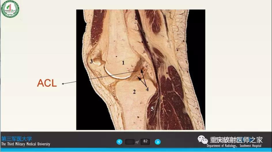 超赞，这个膝关节韧带MRI诊断课件要给满分！