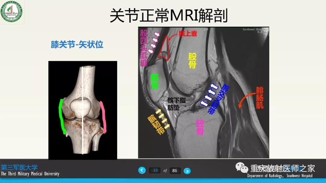 超赞，这个膝关节韧带MRI诊断课件要给满分！