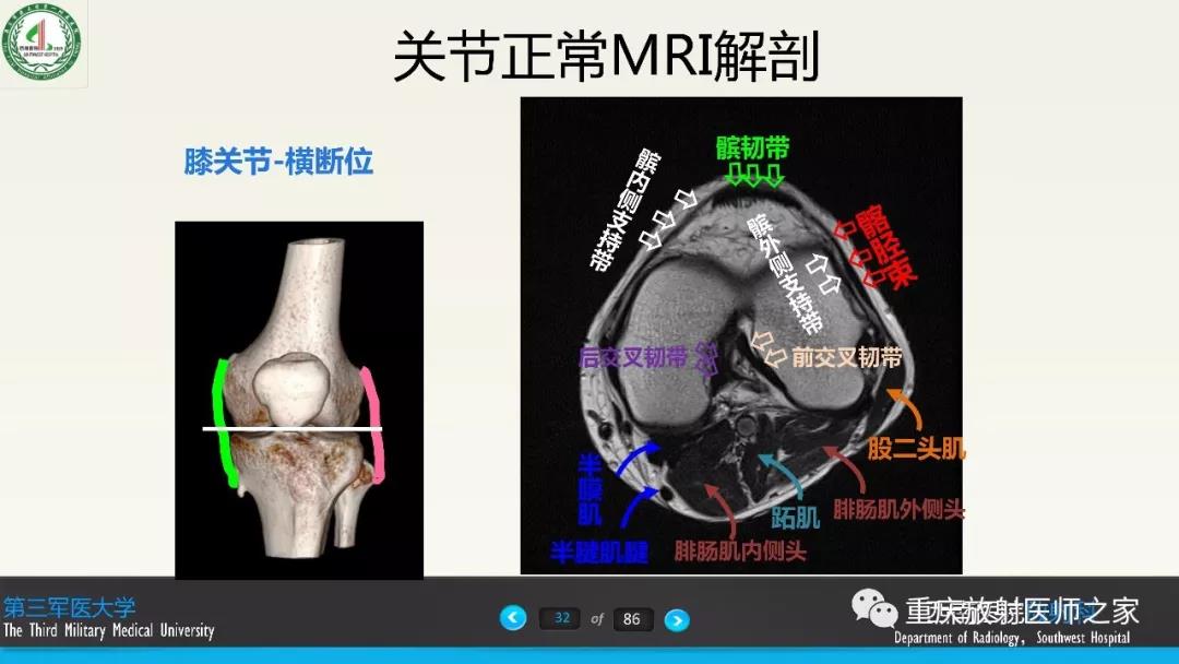 超赞，这个膝关节韧带MRI诊断课件要给满分！