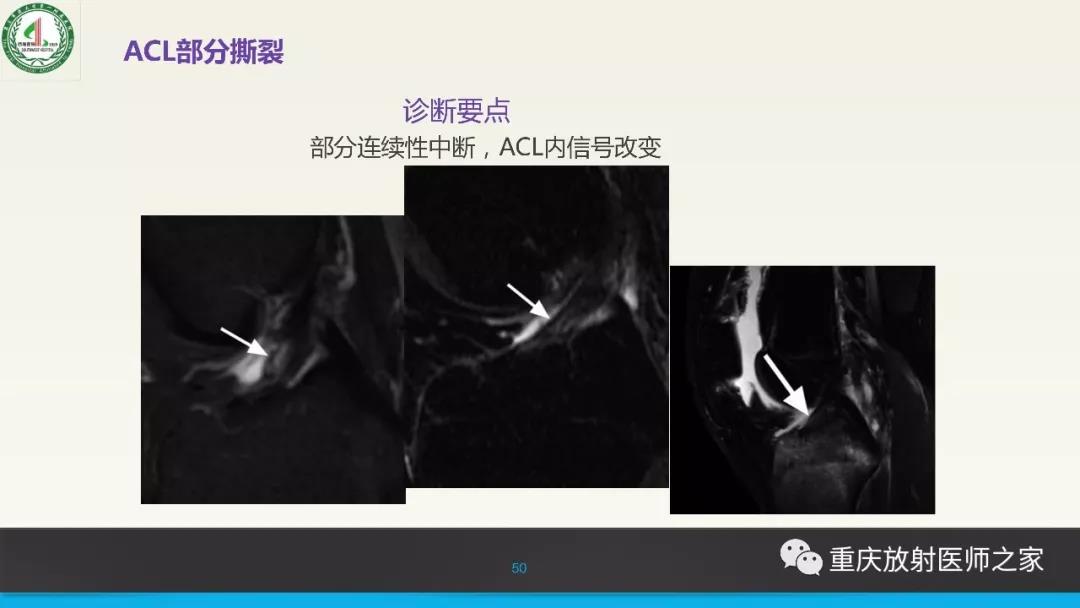 超赞，这个膝关节韧带MRI诊断课件要给满分！