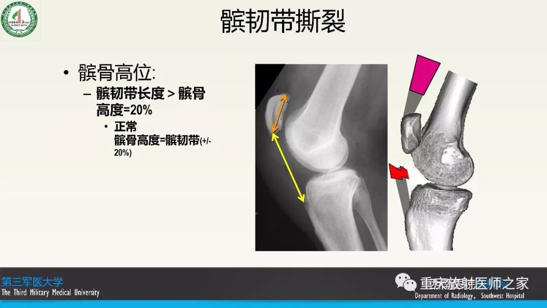 超赞，这个膝关节韧带MRI诊断课件要给满分！