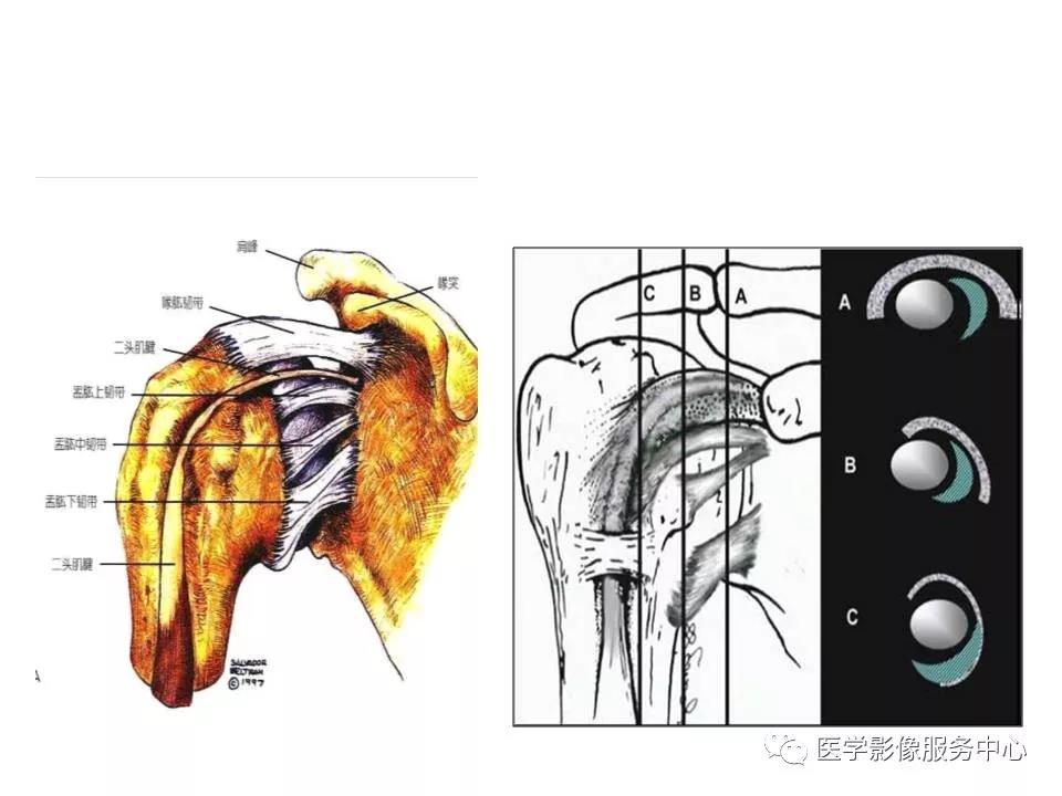 肩关节韧带及损伤的MR表现，都在这里了！