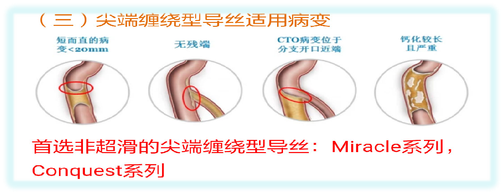 适用3.png