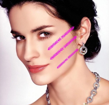 线逆向提升在线雕提升术的应用体会