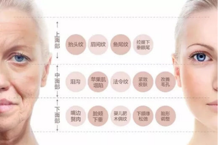 线逆向提升在线雕提升术的应用体会